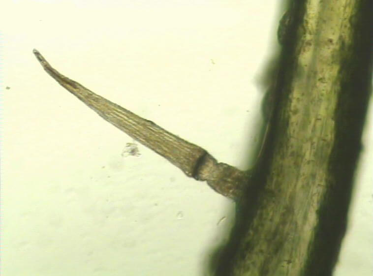 Photo au microscope de la structure d'un trichome sensitif