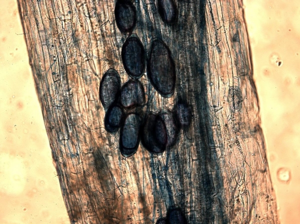 Spore de mycorhizes sur racine de poireau